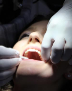 Türk Dişhekimleri Birliği 2020 yılı ağız diş sağlığı muayene ve tedavi ücret tarifesi